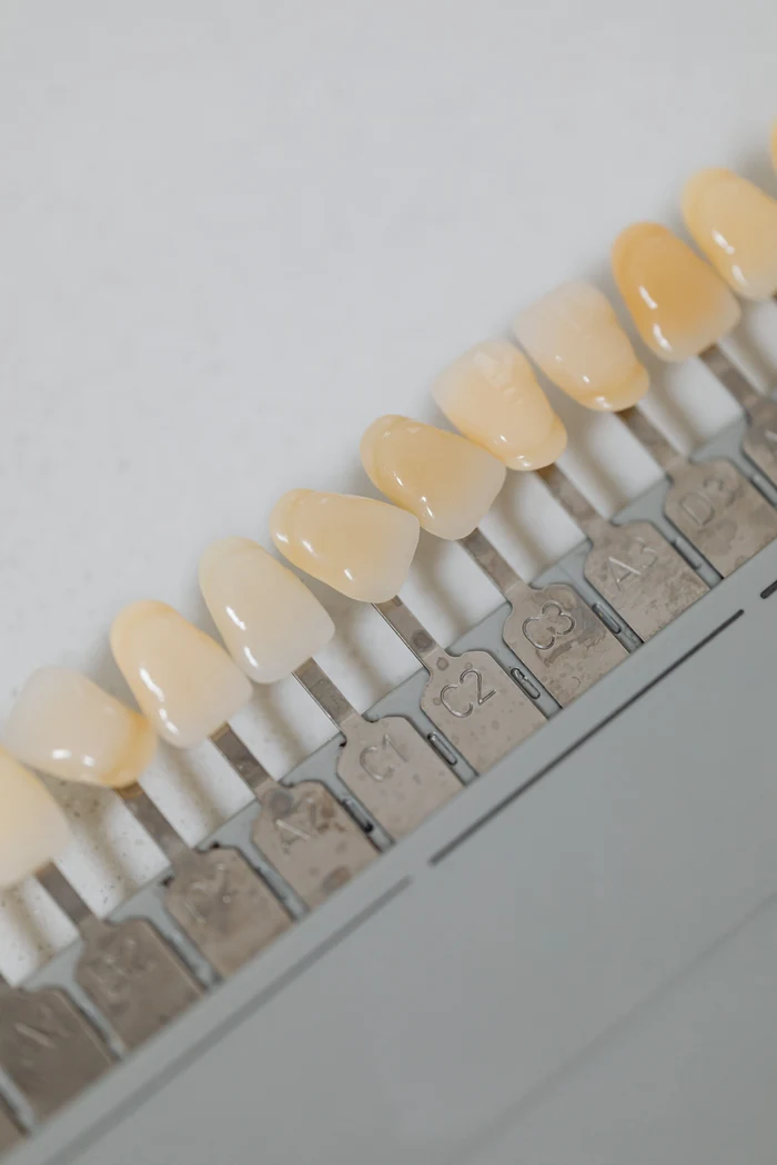 A dental shade guide showing a range of tooth colours
